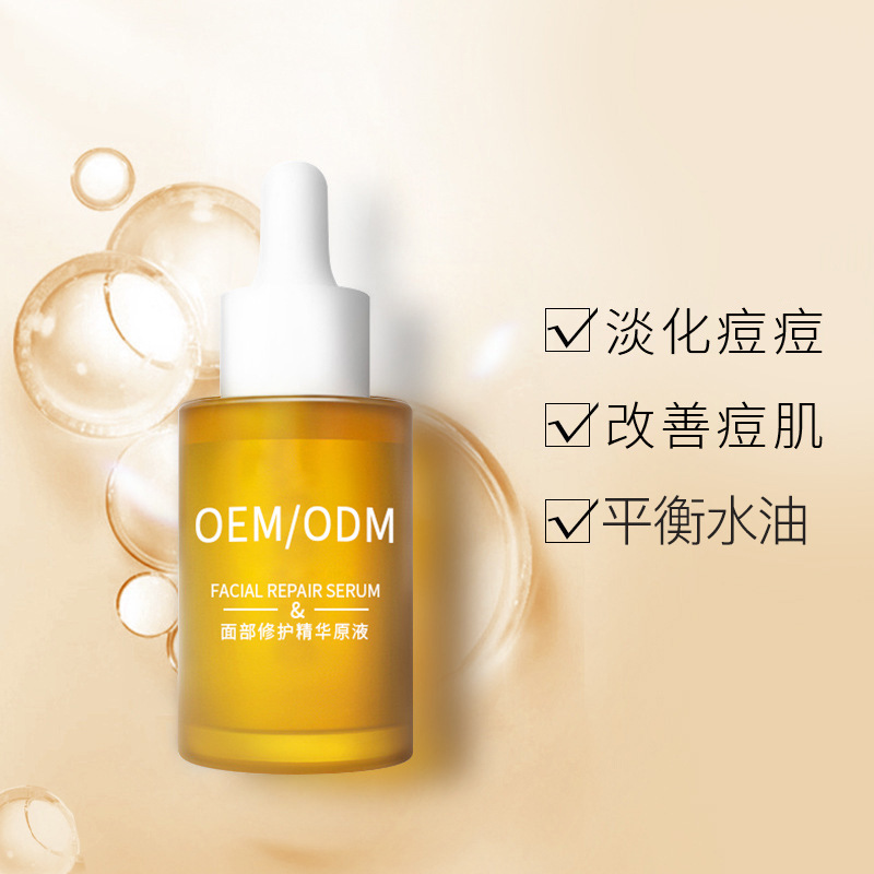 营口市_祛痘精华原液OEM